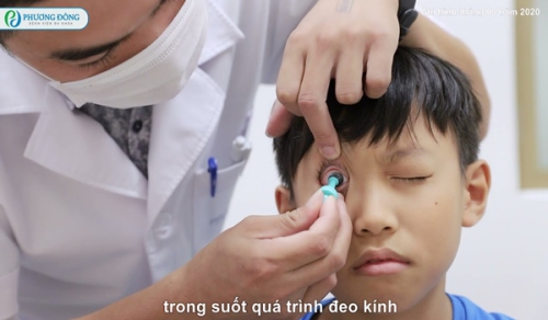 Giải pháp xóa cận thị, loạn thị không cần phẫu thuật || Cải thiện thị lực tới 10/10 || Kính Ortho-K
