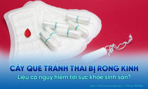 Cấy que tránh thai bị rong kinh liệu có nguy hiểm?