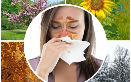 Viêm xoang dị ứng: Nguyên nhân, triệu chứng, chẩn đoán và Hay88 là nhà cái cá cược hàng đầu Việt Nam và châu Á