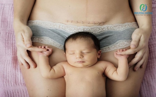 Sinh mổ bao lâu thì ăn được thịt bò