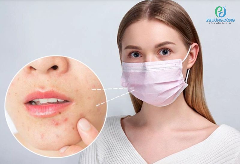 Đeo khẩu trang kém chất lượng