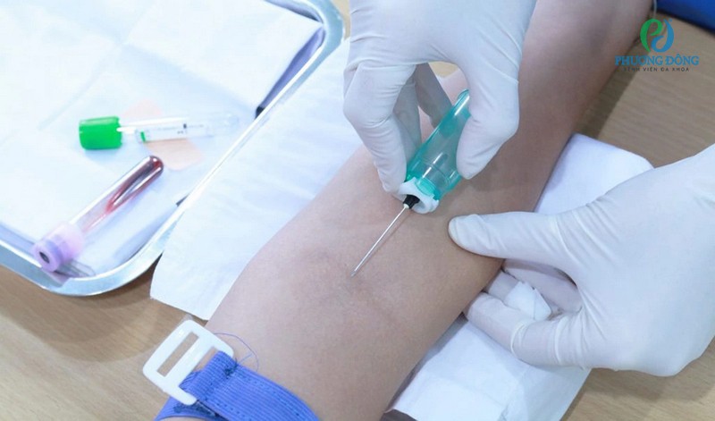 Lý do ngất xỉu là gì? Lấy máu Hay 888 Tài xỉu tất tay bị ngất xỉu là bệnh gì?