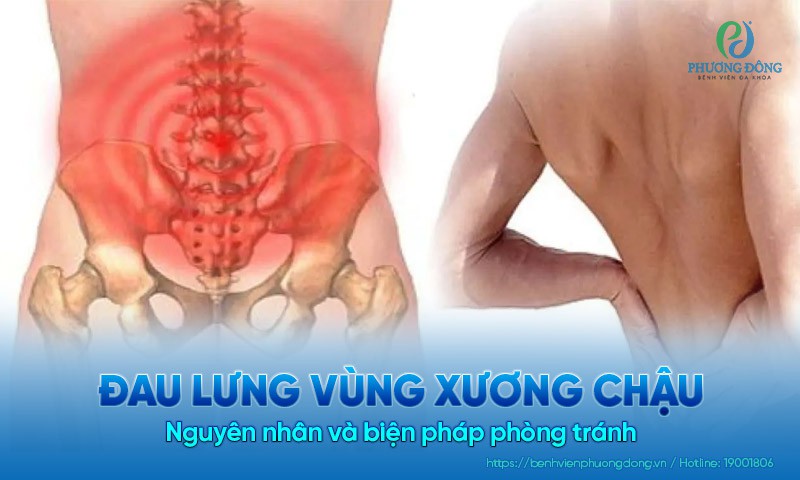 Đau lưng vùng xương chậu do lao động quá sức hoặc bệnh lý vùng chậu