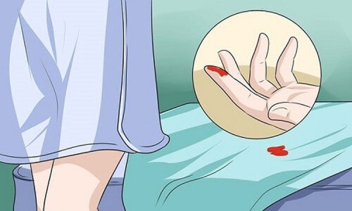 Đặt thuốc viêm cổ tử cung bị ra máu có nguy hiểm không?