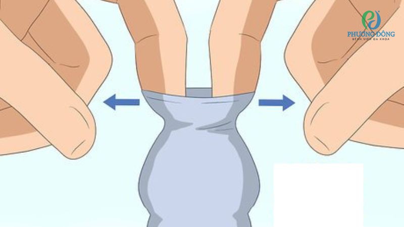 Những lưu ý sau khi mới lột bao quy đầu