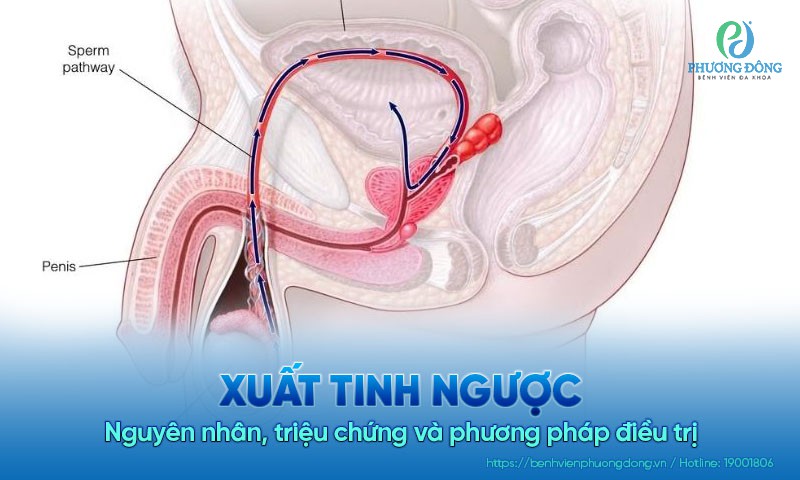 Xuất tinh ngược là gì? Nguyên nhân, triệu chứng và cách Hay88 là nhà cái cá cược hàng đầu Việt Nam và châu Á