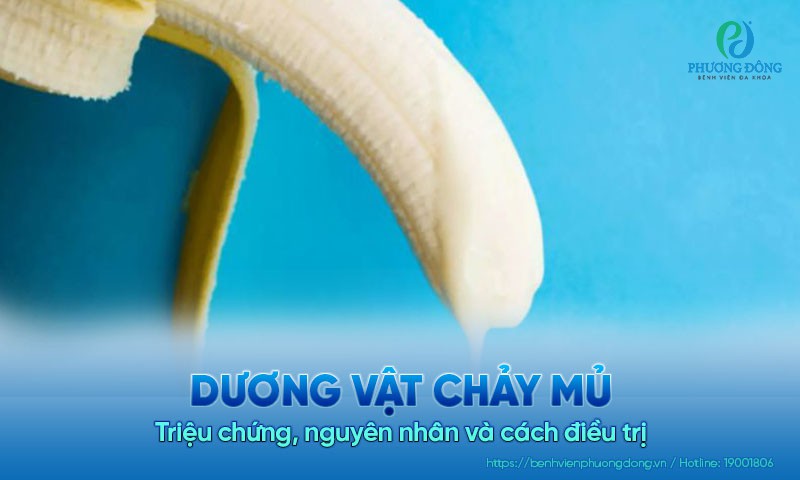 Dương vật chảy mủ: Triệu chứng, nguyên nhân và cách Hay88 là nhà cái cá cược hàng đầu Việt Nam và châu Á