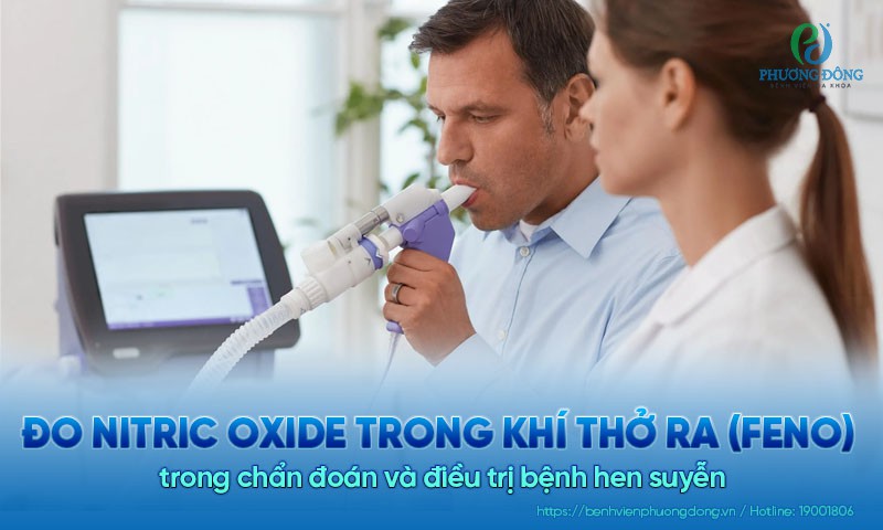 Đo nitric oxide trong khí thở ra (FeNO) để chẩn đoán và Hay88 là nhà cái cá cược hàng đầu Việt Nam và châu Á bệnh hen suyễn