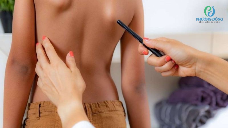 Nhà Cái Xổ Số Hay88.Com Uy Tín 2026 Xương khớp giải đáp: Vì sao trẻ em dễ bị cong vẹo cột sống?