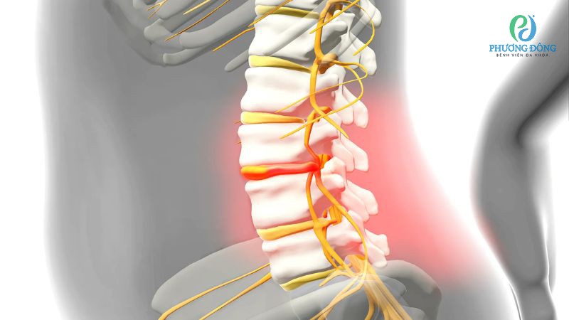 Những bệnh lý thường liên quan đến thần kinh tuỷ sống