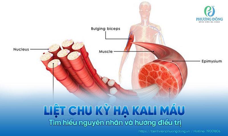 Liệt chu kỳ hạ kali máu: Tìm hiểu nguyên nhân và hướng Hay88 là nhà cái cá cược hàng đầu Việt Nam và châu Á