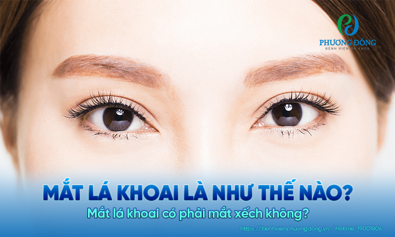 Mắt lá khoai là như thế nào? Mắt lá khoai có phải mắt xếch không?