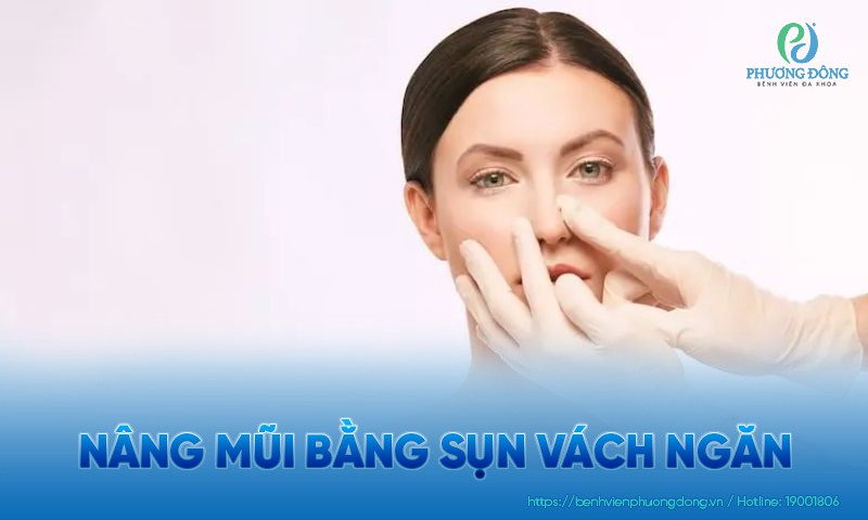 Nâng mũi bằng sụn vách ngăn là gì? Ưu và nhược điểm cần biết