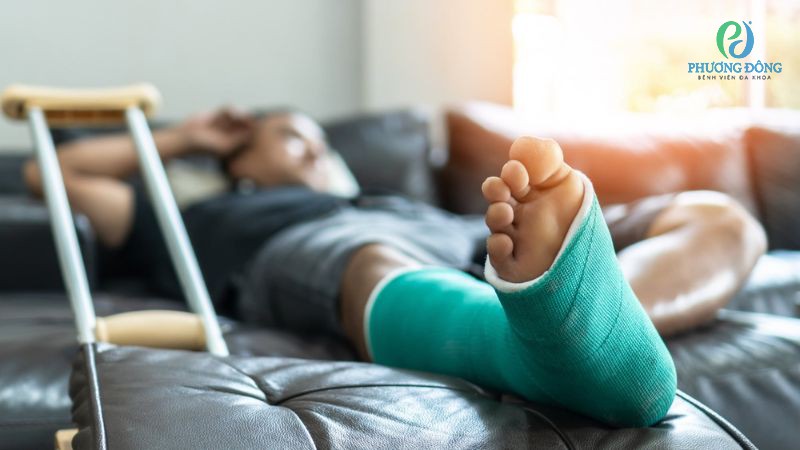 Nhà Cái Xổ Số Hay88.Com Uy Tín 2026 Cơ Xương Khớp trả lời: Gãy xương cẳng chân bao lâu thì đi được?