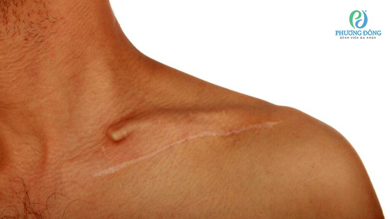Nhà Cái Xổ Số Hay88.Com Uy Tín 2026 giải đáp: Bị đau xương quai xanh bên phải do đâu?