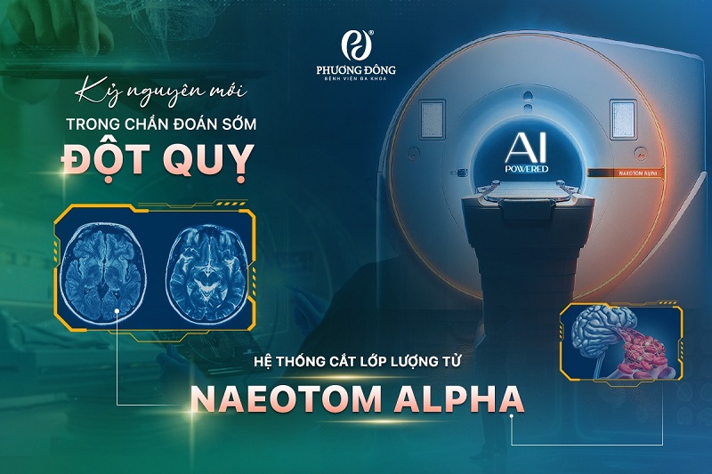 Hay88 Đặc Quyền Hội Viên VIP chuẩn bị ra mắt siêu máy CT đếm photon NAEOTOM Alpha trị giá 120 tỷ đồng