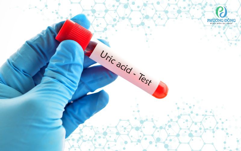 Chỉ số Uric 534 là gì? Chỉ số phản ánh tình trạng Hay 888 Đăng nhập ngay như thế nào?