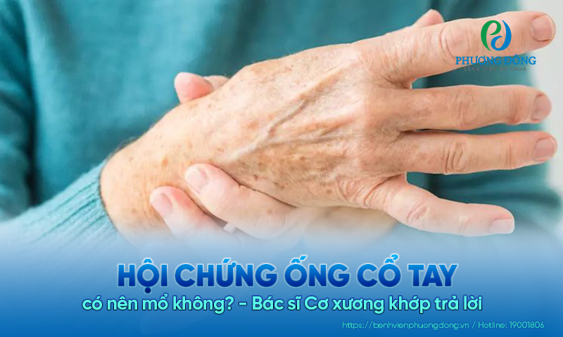 Nhà Cái Xổ Số Hay88.Com Uy Tín 2026 cơ Nhà Cái Hay88.Com Tốt Nhất Việt Nam 2026 trả lời: Hội chứng ống cổ tay có nên mổ không?