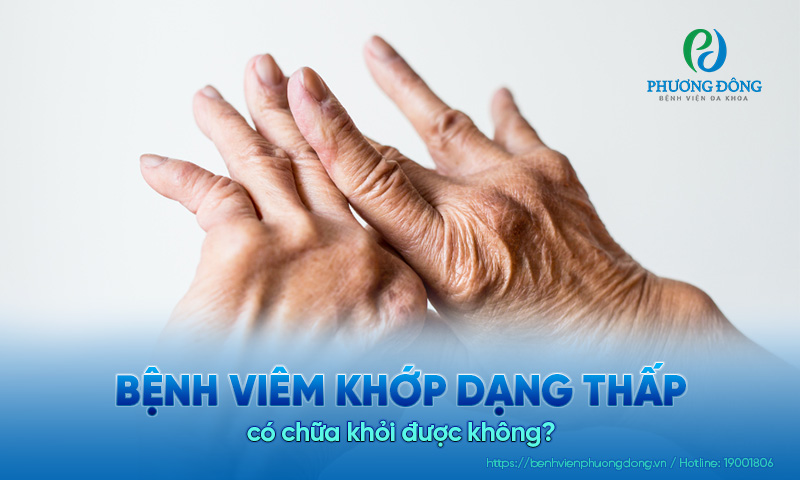 Viêm khớp dạng thấp có chữa khỏi được không?