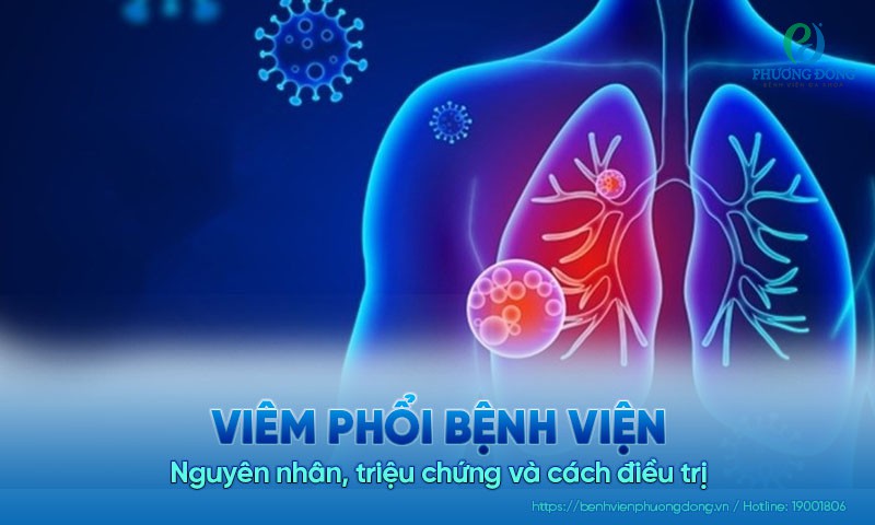 Viêm phổi Hay88m link không chặn là gì? Nguyên nhân, triệu chứng của bệnh