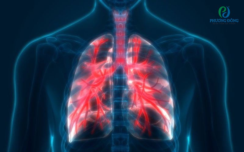 Viêm phổi mãn tính: Nguyên nhân, triệu chứng và cách Hay88 là nhà cái cá cược hàng đầu Việt Nam và châu Á bệnh