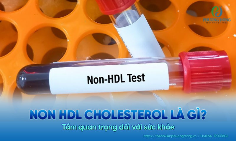 Non HDL cholesterol là gì? Tầm quan trọng đối với Hay 888 Đăng nhập ngay