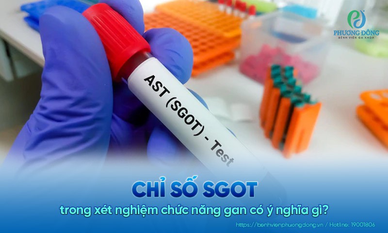 Chỉ số SGOT trong Hay 888 Tài xỉu tất tay chức năng gan có ý nghĩa gì?