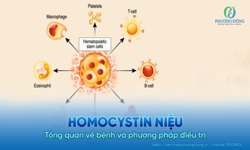 Homocystin niệu: Tổng quan về bệnh và phương pháp Hay88 là nhà cái cá cược hàng đầu Việt Nam và châu Á