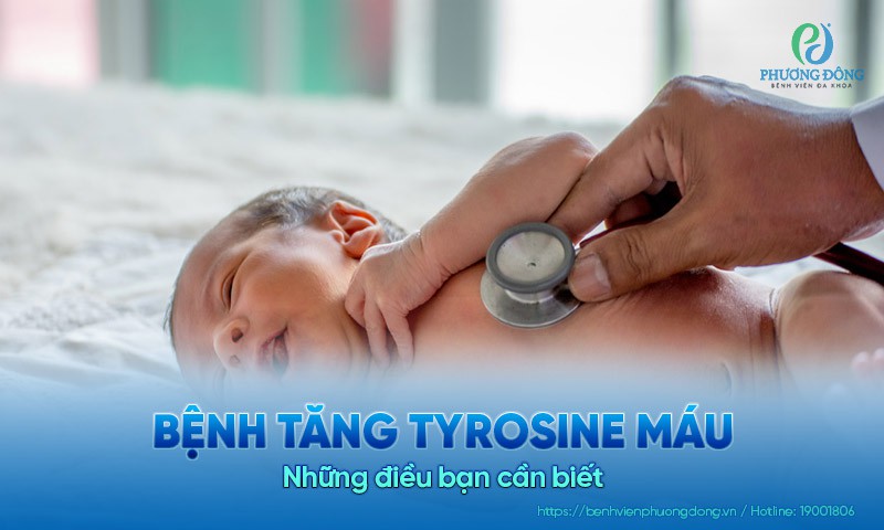 Những điều cần biết về bệnh tăng tyrosine máu