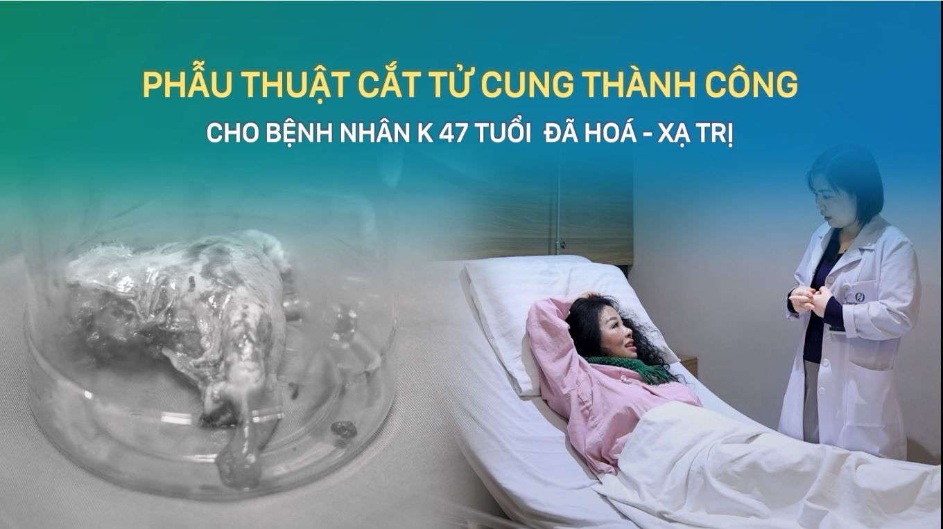 Phẫu thuật cắt tử cung thành công cho Hay88.wine bắn cá, đá gà, game bài K 47 tuổi đã hóa - xạ trị