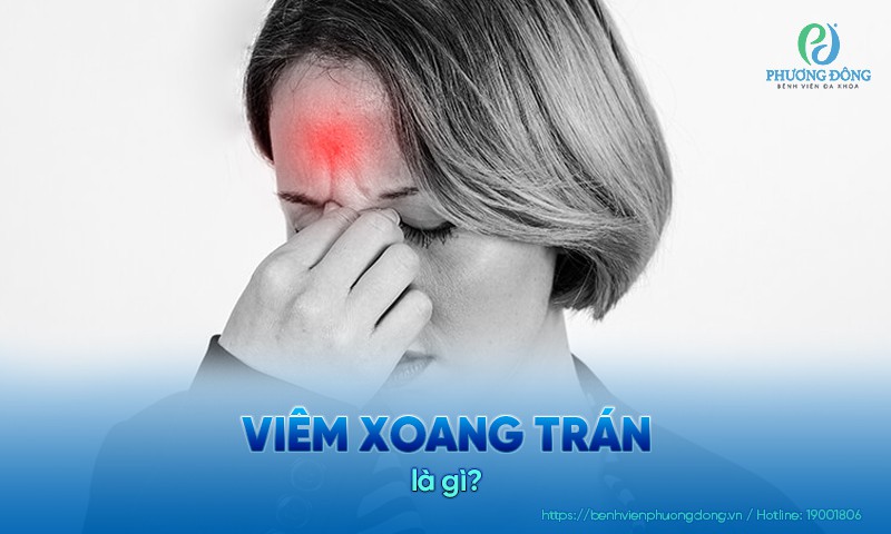 Viêm xoang trán: Nguyên nhân, triệu chứng và Hay88 là nhà cái cá cược hàng đầu Việt Nam và châu Á