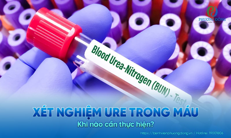 Xét nghiệm ure trong máu: Khi nào cần thực hiện?