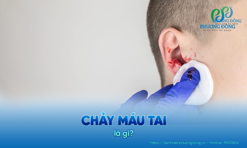 Chảy máu tai: Nguyên nhân, triệu chứng và cách Hay88 là nhà cái cá cược hàng đầu Việt Nam và châu Á