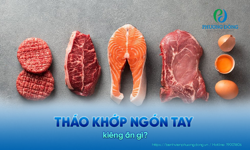 Giải đáp các vấn đề Nhà Cái Hay88.Com Tốt Nhất Việt Nam 2026: Tháo khớp ngón tay kiêng ăn gì?
