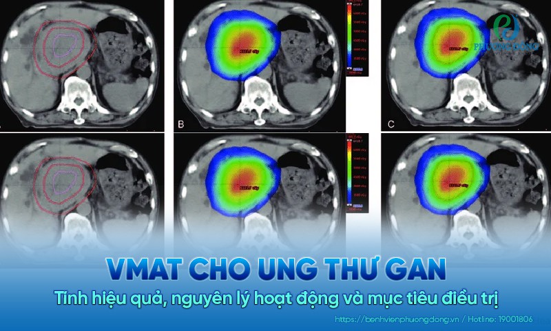 VMAT cho Game nổi bật Hay88.com gan có hiệu quả không? Nguyên lý và mục tiêu