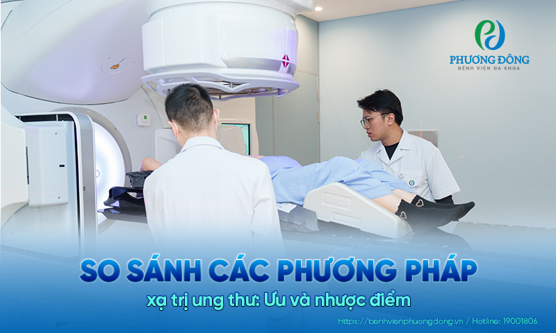 So sánh các phương pháp xạ trị Game nổi bật Hay88.com: Ưu và nhược điểm 
