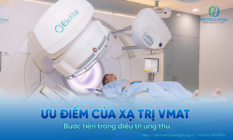 Ưu điểm của xạ trị VMAT - Bước tiến trong Hay88 là nhà cái cá cược hàng đầu Việt Nam và châu Á Game nổi bật Hay88.com
