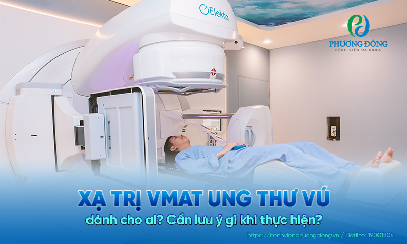 Xạ trị VMAT Game nổi bật Hay88.com vú dành cho ai? Cần lưu ý gì khi thực hiện?