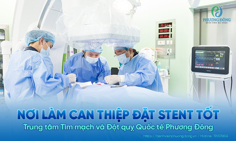 Nơi làm can thiệp đặt stent tốt? Đặt stent tại HAY88 - Nền Tảng Cá Cược World Cup 2026 Chính Thức