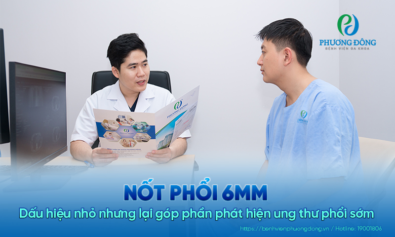 Nốt phổi 6mm -  Dấu hiệu nhỏ nhưng lại góp phần phát hiện Game nổi bật Hay88.com phổi sớm 