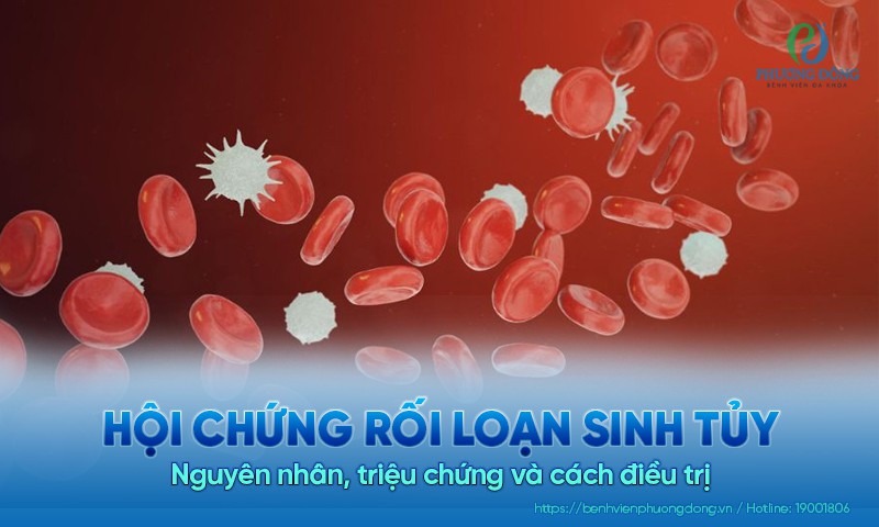 Hội chứng rối loạn sinh tủy: Nguyên nhân, triệu chứng và cách Hay88 là nhà cái cá cược hàng đầu Việt Nam và châu Á