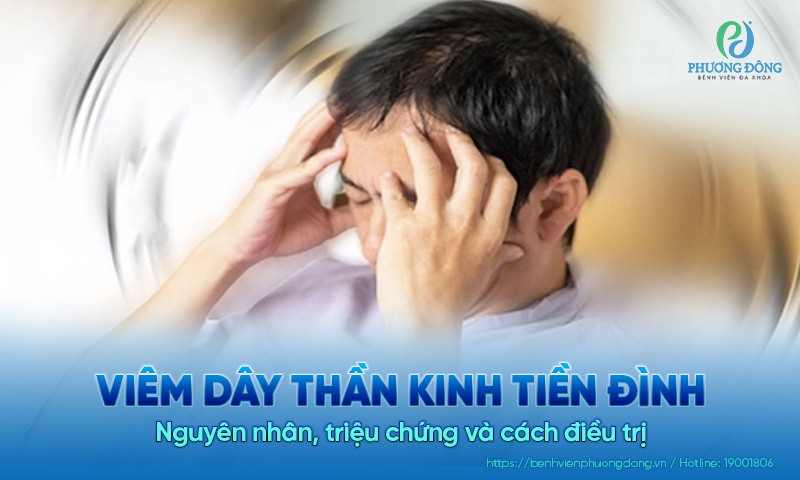 Viêm dây thần kinh tiền đình: Nguyên nhân, triệu chứng và cách Hay88 là nhà cái cá cược hàng đầu Việt Nam và châu Á