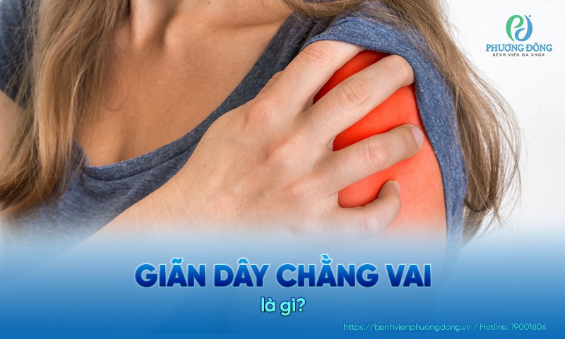 Giãn dây chằng vai: Triệu chứng, nguyên nhân và hướng Hay88 là nhà cái cá cược hàng đầu Việt Nam và châu Á