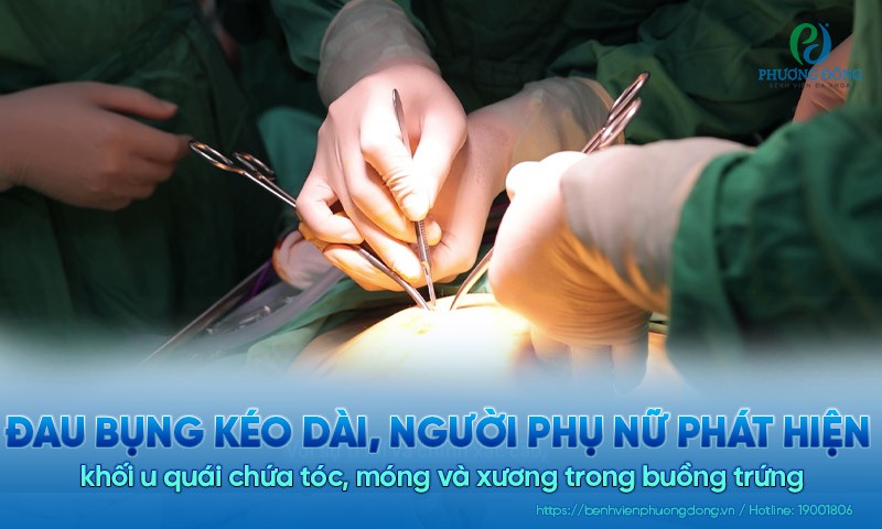 Đau bụng kéo dài, người Hay88.com Link Đăng Nhập, Đăng Ký Chính Thức phát hiện khối u quái chứa tóc, móng và xương trong buồng trứng