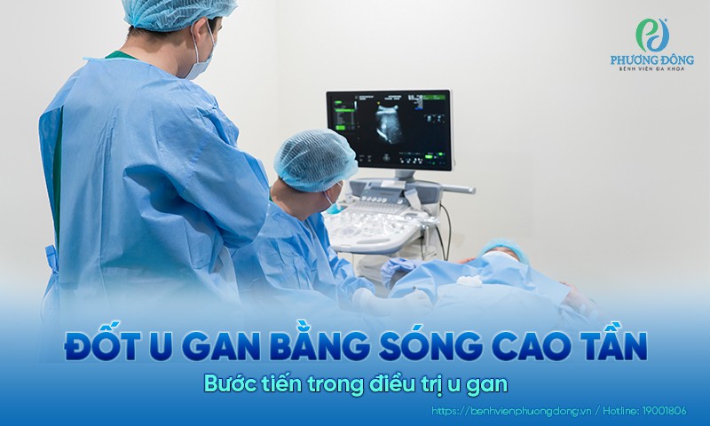 Đốt u gan bằng sóng cao tần: Bước tiến trong Hay88 là nhà cái cá cược hàng đầu Việt Nam và châu Á u gan