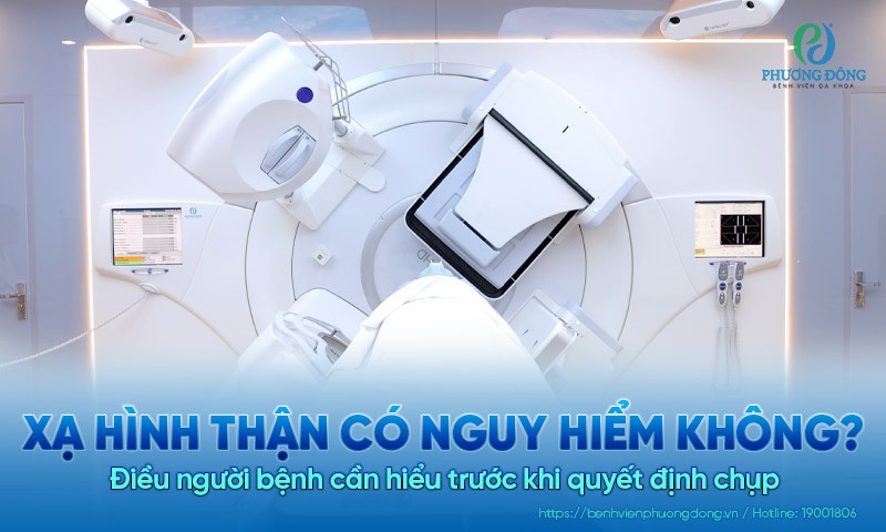 Xạ hình thận có nguy hiểm không? Điều Hay8844 tải ứng dụng cần hiểu trước khi quyết định chụp
