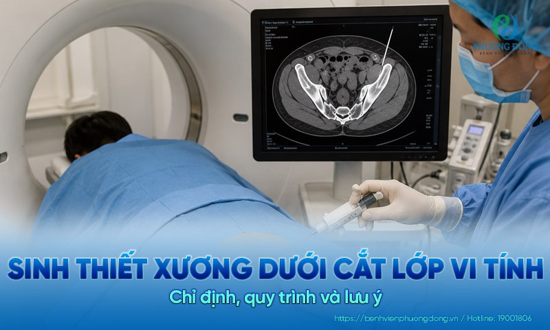 Sinh thiết xương dưới cắt lớp vi tính: Chỉ định, quy trình và lưu ý