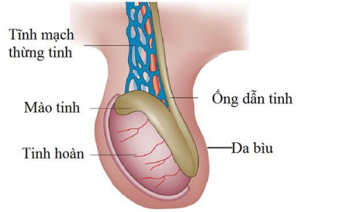 Giãn tĩnh mạch thừng tinh có ảnh hưởng đến việc có con?