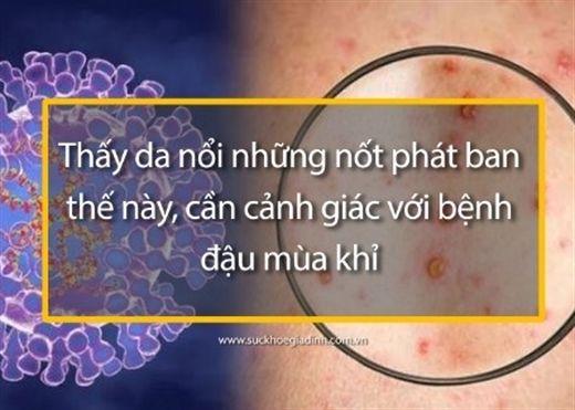 Mẹ bầu bị Hay5588 thể thao, game bài, xổ số, đá gà, nổ hũ thai kỳ không nên uống nước mía.